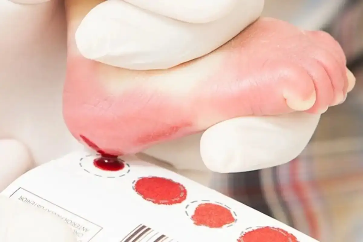 Teste do pezinho ampliado já funciona em MS e identifica mais de 40 doenças