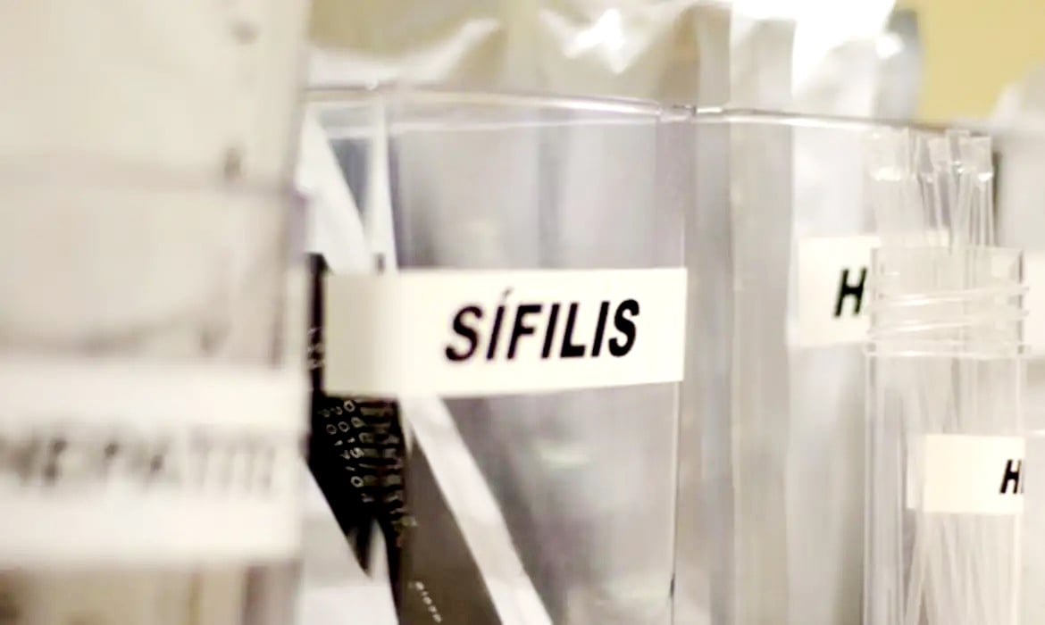 SUS adota DoxiPEP para prevenção pós-relação sexual contra ISTs